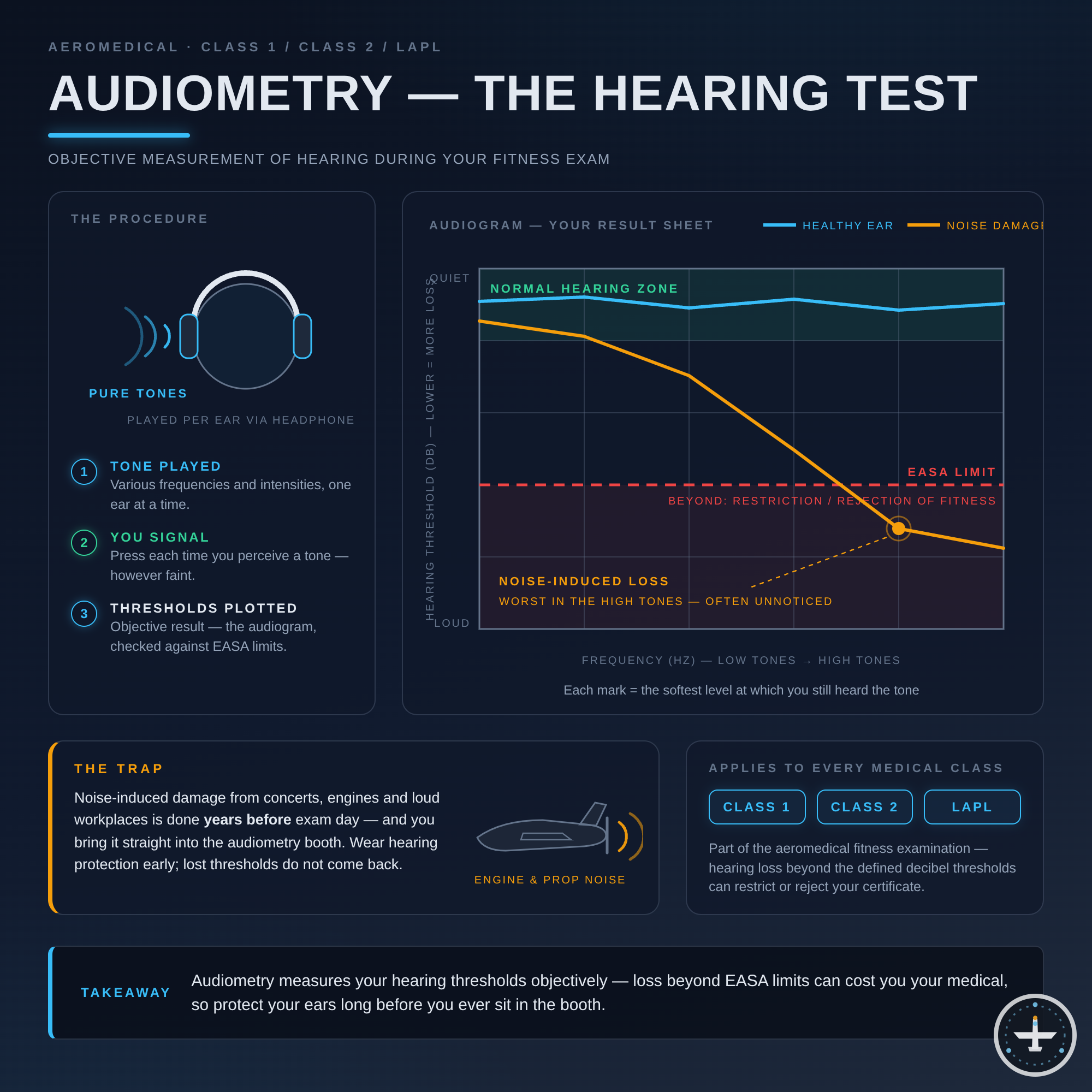 Audiometrie